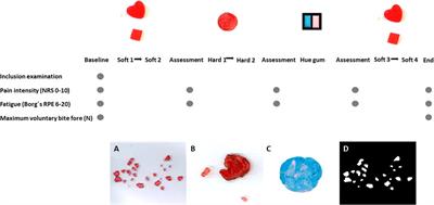 Masticatory performance in patients with jaw muscle pain: A case control study